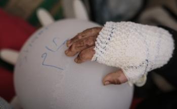 MSF, Doctors Without Borders, MSF survey reveals almost half of people killed in Gaza are children