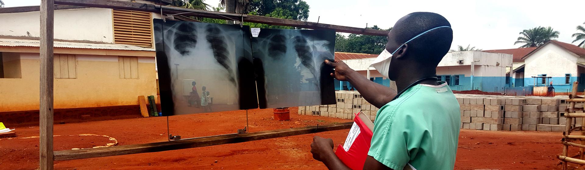 Checking XRays in the Central African Republic