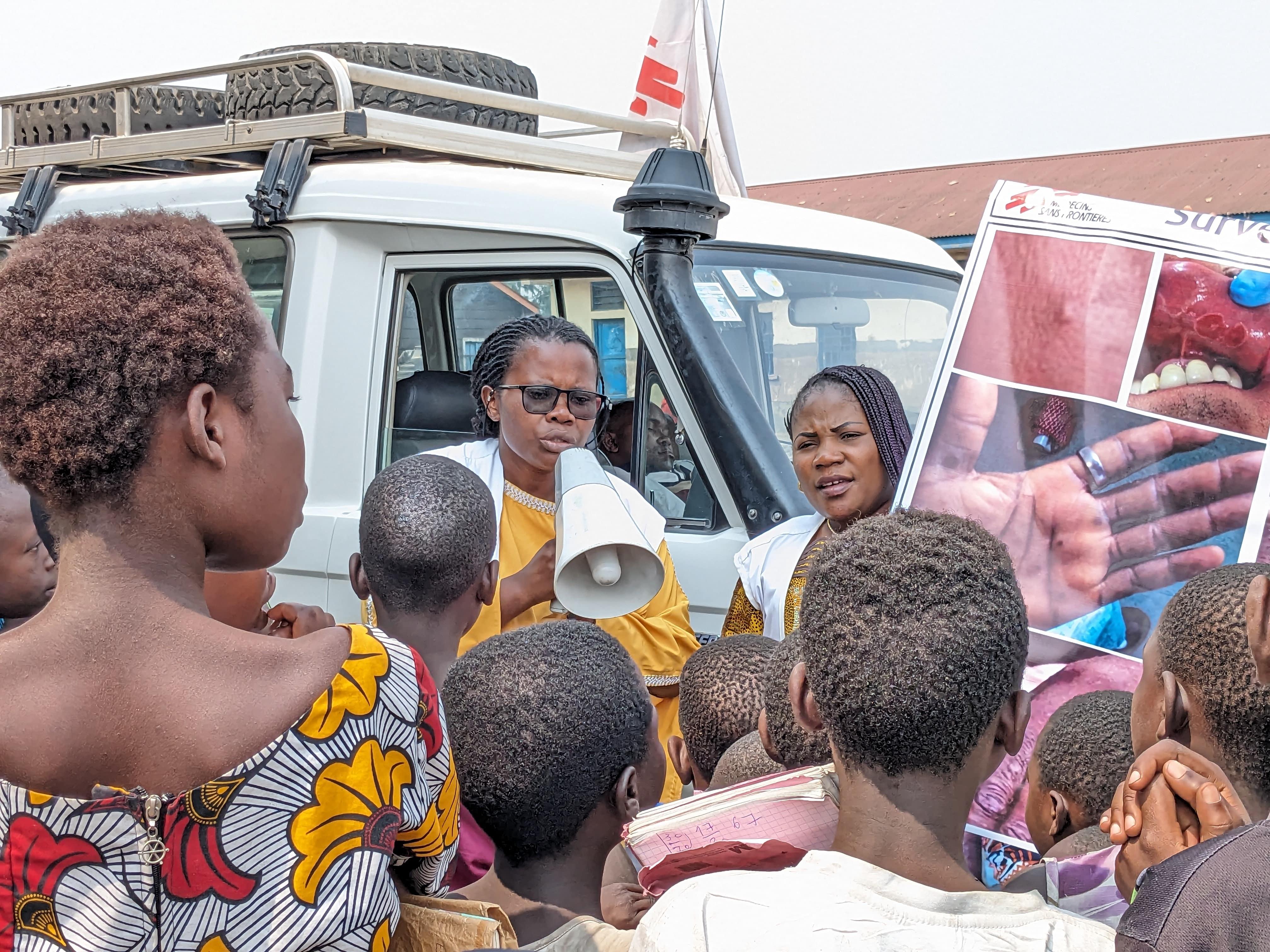 Mpox Vaccines -MSF health promotion workers raise awareness about Mpox in the Kanyaruchinya IDP site. The Mpox epidemic is increasingly affecting people displaced by armed conflict in Goma, North Kivu. 