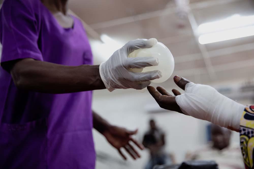 A picture of France doing exercise to strengthen her arm at SICA Hospital