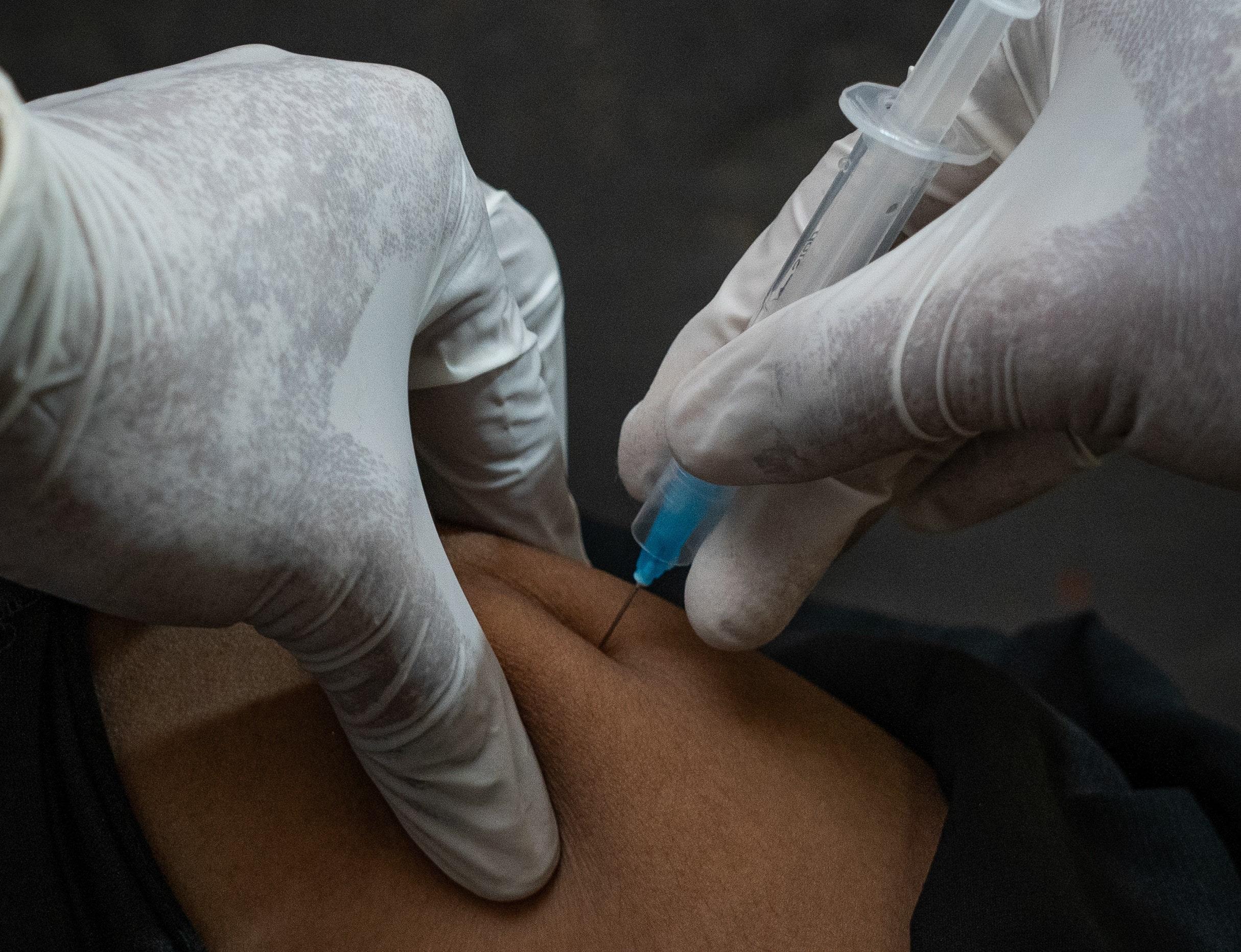 Hep C in Cox's Bazar MSF staff is administrating vaccine to a patient at the outpatient department of MSF’s Hospital on the hill facility.