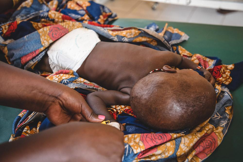 MSF, Doctors Without Borders, Kenya, Malnutrition crisis