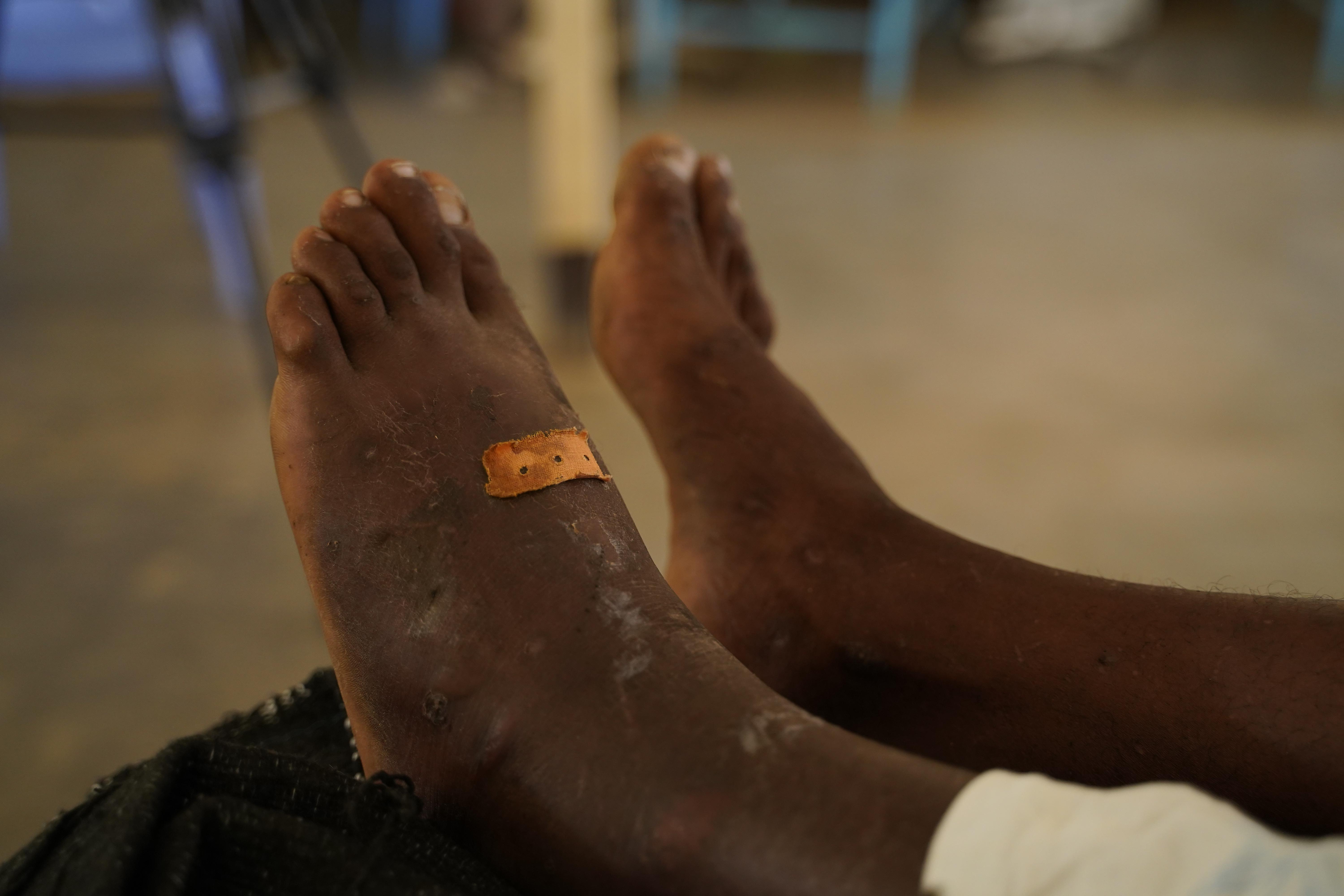 Doctors Without Borders, MSF, Tropical diseases