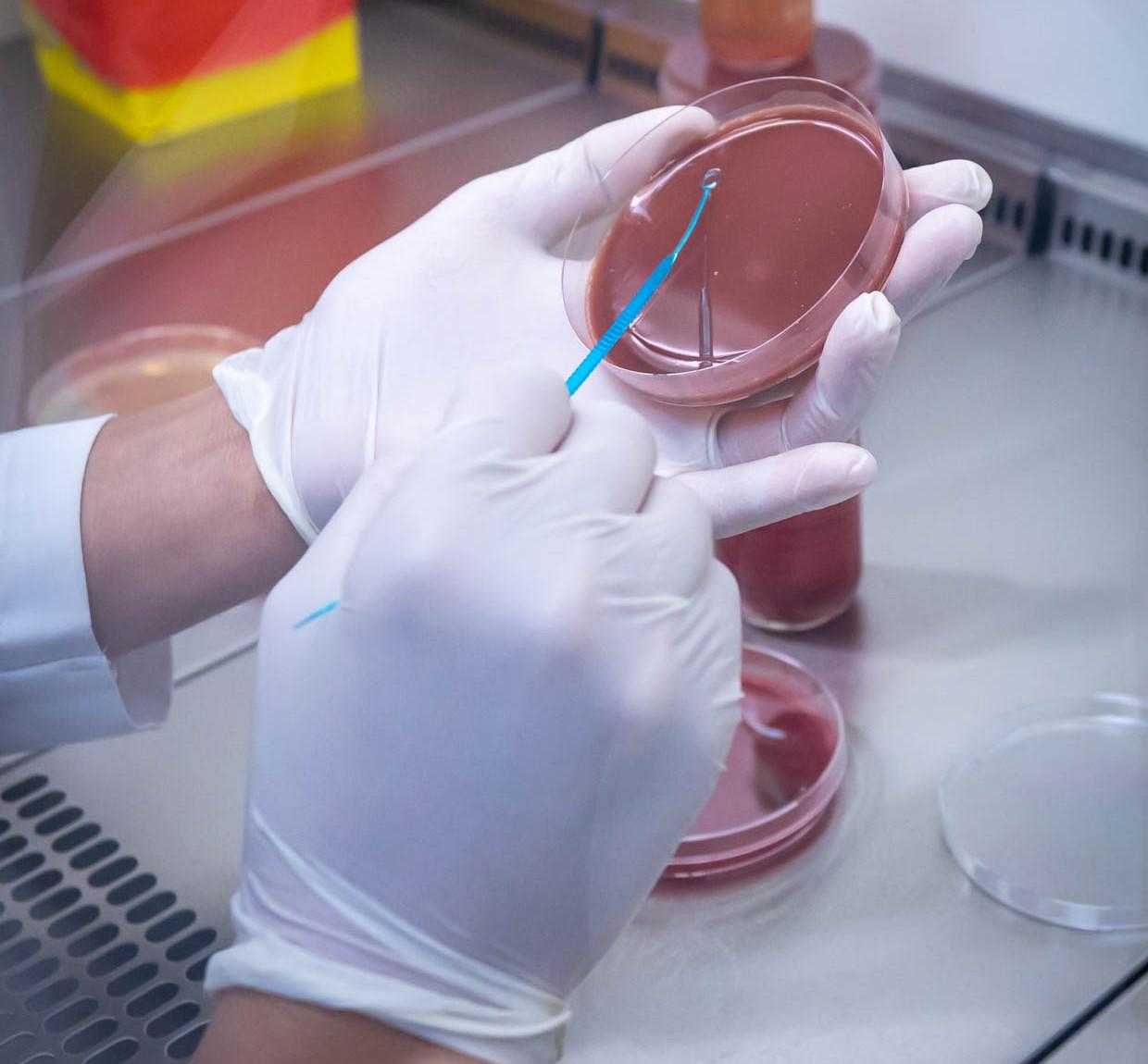 A lab technician at MSF's reconstructive surgery hospital in Amman seeds culture media. Helping prevent the increase of antibiotic resistant bacteria in low-income countries.