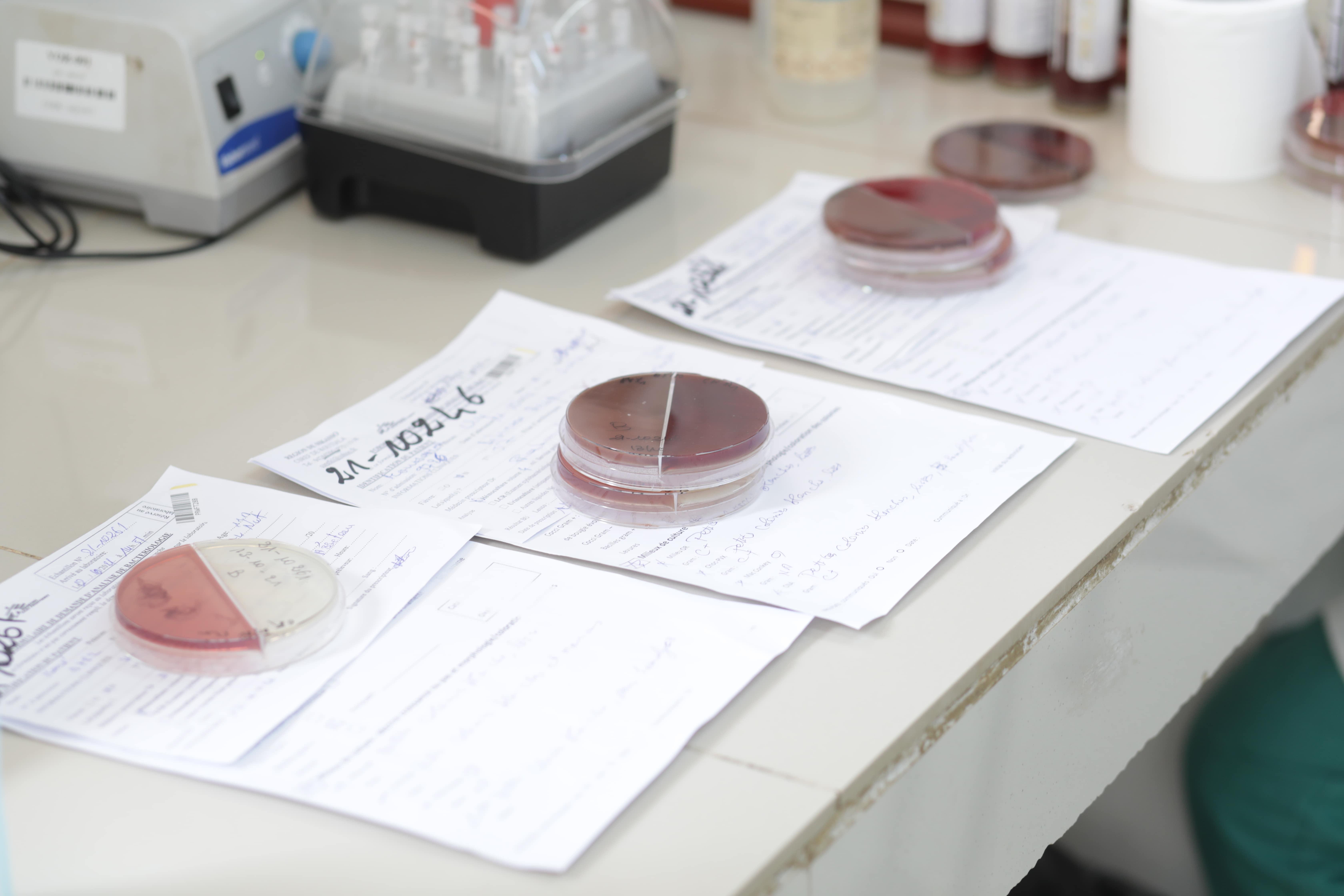 A line of petri dishes in a lab for testing. Low-income countries can use Antibiogo to analyse petri dishes.