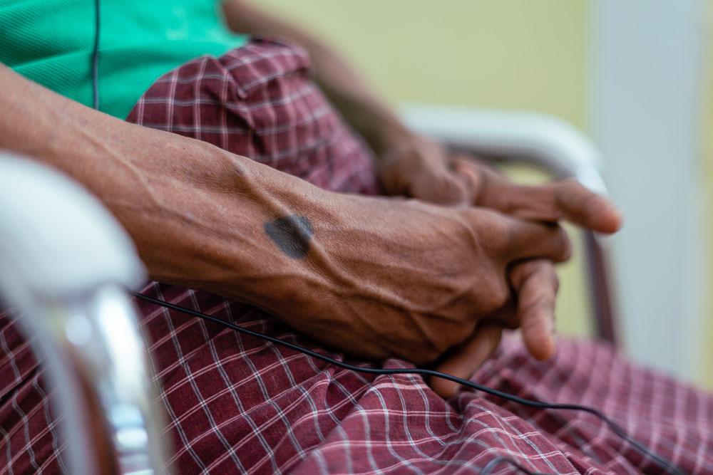 An HIV/hepatitis C patient receives a consultation in Yangon's MSF office. 